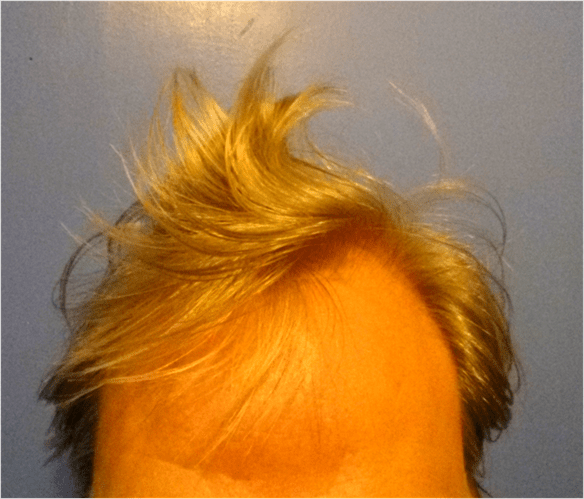 Not a Thumb in sight